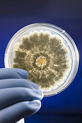 Petri dish containing the fungus Aspergillus flavus: Click here for full photo caption.
