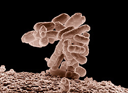 E. coli, magnified about 7,000x: Click here for photo caption.