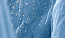 Scanning electron microscope image of silver nanoparticles on the surface of cotton: Click here for full photo caption.