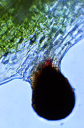 Microscopic view of hypericin-containing gland.