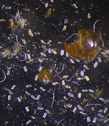 Nematode eggs and juveniles of the golden nematode, Globodera rostochiensis: Click here for full photo caption.