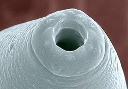 Mouth parts of a Parasitorhabditis frontali nematode: Click here for photo caption.
