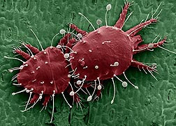 Colorized scanning electron micrograph of a pair of red palm mites: Click here for full photo caption.