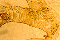 A bee trachea infested with mites: Click here for full photo caption.
