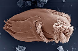 The protozoan Ophryoscolex spp.: Click here for full photo caption.