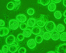 Infected cells from cabbage looper: Click here for full photo caption.