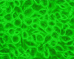 Healthy cells from cabbage looper: Click here for full photo caption.