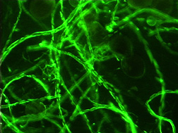 Thin, threadlike strands of mycorrhizal hyphae from pot cultures have an abundant amount of glomalin—seen on their surface as bright green spots here after a laboratory procedure: Click here for full photo caption.
