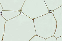 Fat tissue from a mouse: Click here for full photo caption.
