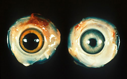Left: Normal chicken eye. Right: Eye with lesions and irregular pupil caused by Marek’s disease: Click here for photo caption.