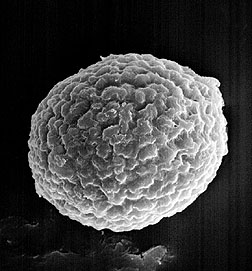 A scanning electron micrograph of a Karnal bunt spore. Click here for full photo caption.