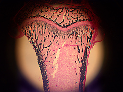 Cross-section of leg bone from a control-fed rat as viewed with fluorescent microscopy. The black-stained areas are newly formed bone, and the pink and white areas are bone marrow: Click here for photo caption.