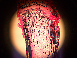 Cross-section of leg bone from a blueberry-fed rat as viewed with fluorescent microscopy. The black-stained areas are newly formed bone, and the pink and white areas are bone marrow: Click here for photo caption.