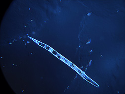 A second-stage juvenile of the root-knot nematode Meloidogyne incognita (about 1/3 millimeter long): Click here for photo caption.