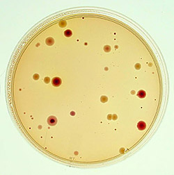 A 20-minute-old agar plate culture from an air sample: Click here for full photo caption.