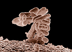 Low-temperature electron micrograph of a cluster of E. coli bacteria, which can cause mastitis in cows: Click here for full photo caption.