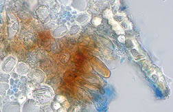 Micrografía de la roya naranja emergiendo de una hoja de la caña de azúcar 