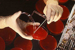 Photo: Researcher searches blood agar plate for Campylobacter bacteria. Click for photo information.