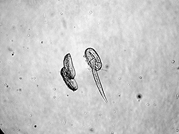 Microscope image of a juvenile pale cyst nematode (right) emerging from an egg: Click here for photo caption.