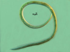 Juvenile nematode Anquina Tritici
