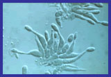 Photo of Spores of D. destructiva which causes Dogwood Anthacnose