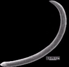 Photo of nematode parasite of the coffee berry borer, Hypothenemus hampei