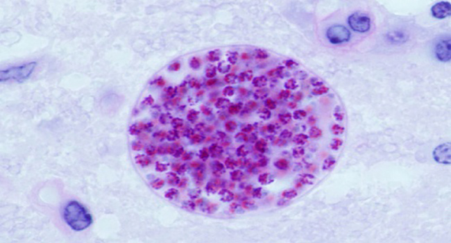 Toxoplasma gondii cyst