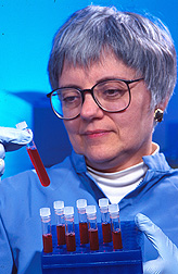 Chemist Norberta Schoene prepares blood samples for analysis.
