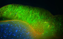 Photo: Close-up view through a fluorescence microscope of a barley seed glowing green where it is infected with Fusarium graminearum. Link to photo information