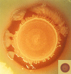 Photo: Salmonella bacteria colony. Link to photo information