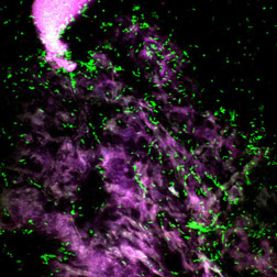 Microscopic fluorescent green Campylobacter cells on chicken skin. Link to photo information