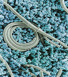 Scanning electron micrograph of Salmonella cells. Link to photo information