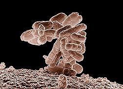 Photo: Electron micrograph of E. coli bacteria. Link to photo information
