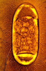 Salmonella typhimurium bacterium.