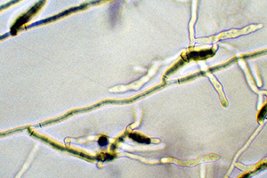 Rhizoctonia mycelium