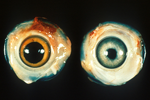 A normal chicken eye next to an eye with an irregular pupil and eye lesions caused by Marek's disease.
