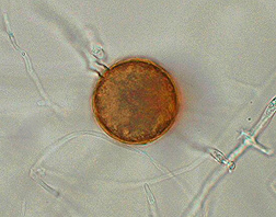 Phytophthora ramorum spore