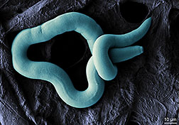 An electron microscope image of a wormlike nematode