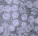 Photo: Electron micrograph