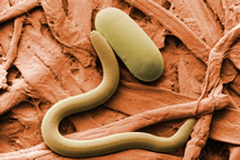 Low-temperature scanning electron micrograph of soybean cyst nematode and its egg. 