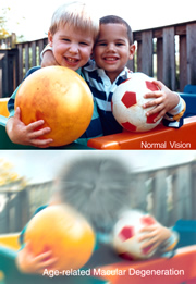 Photo: Two photos of a pair of young boys, each holding a ball. One scene is normal, but lower scene is distorted to simulate how it might be viewed by a person with age-related macular degeneration.