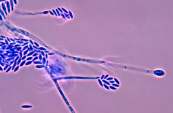 Photomicrograph revealing the conidiophores and conidia of the fungus Fusarium verticillioides. 