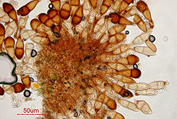 Photo: Micrograph of Puccinia graminis, the fungus that causes wheat stem rust.