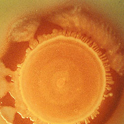 Photo: A large colony of Salmonella enteritidis.